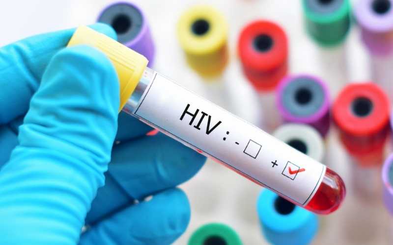 HIV é a sigla em inglês para vírus da imunodeficiência humana pois ataca o sistema imunológico, responsável por combater as doenças que atingem o corpo. É o vírus causador da aids